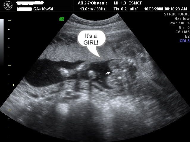 Ultrasound Fetus Sex